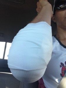 bandandage elbow